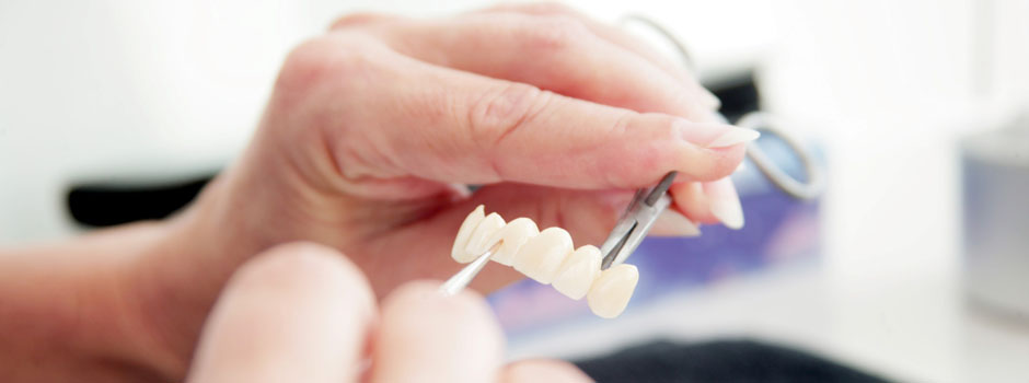 Prothèse dentaire : comment choisir?